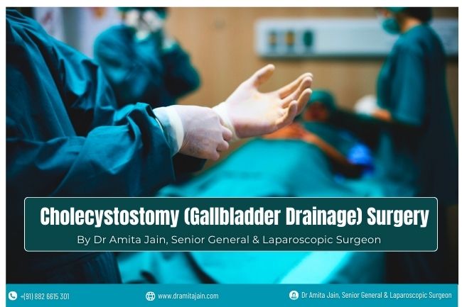 Cholecystostomy Gallbladder Drainage Surgeon Dr Amita Jain India